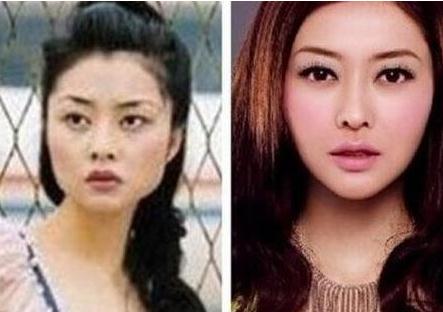 郭富城熊黛林接吻图片曝光,熊黛林整容前丑样吓坏郭富城