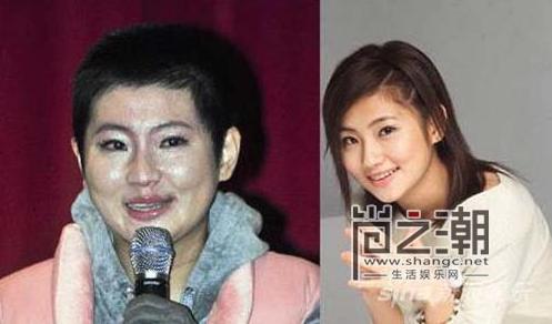 selina老公嫌弃她烧伤,selina烧伤前后对比,selina离婚背后真相