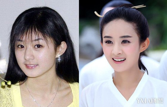 赵丽颖整容前照片曝光,揭秘赵丽颖个人简历资料及家庭背景图片