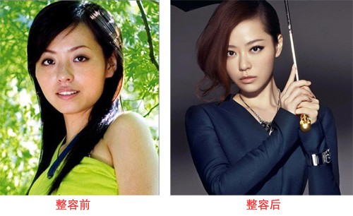 张靓颖整容前后照片,超女张靓颖的老公冯轲个人资料及背景