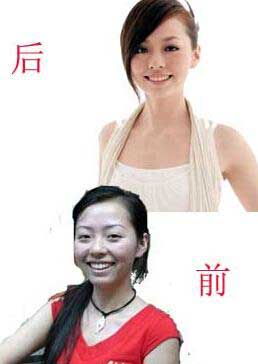 张靓颖整容前后照片,超女张靓颖的老公冯轲个人资料及背景