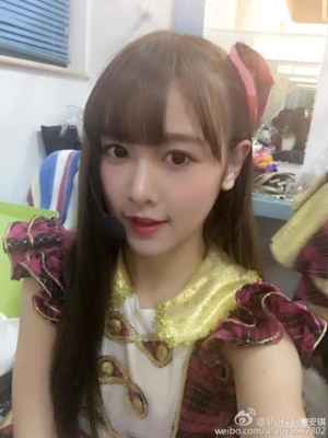 snh48唐安琪烧伤现场图片曝光,唐安琪为什么被烧伤原因及最新近况