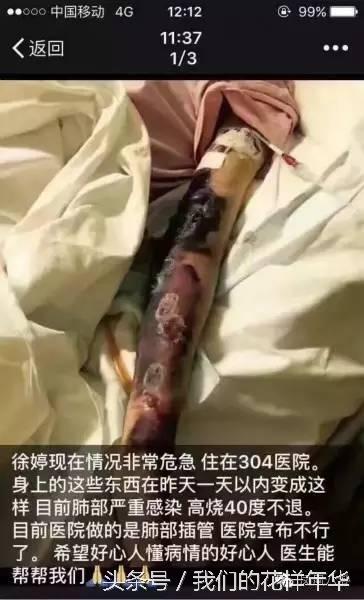 女星徐婷去世照片曝光,揭秘90后女星徐婷去世原因及生前照片
