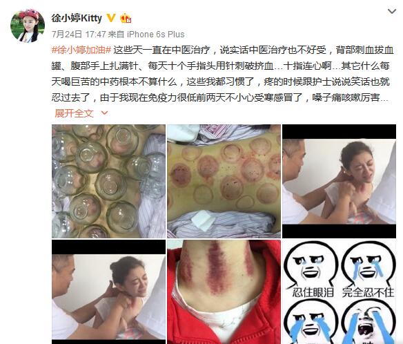 女星徐婷去世照片曝光,揭秘90后女星徐婷去世原因及生前照片