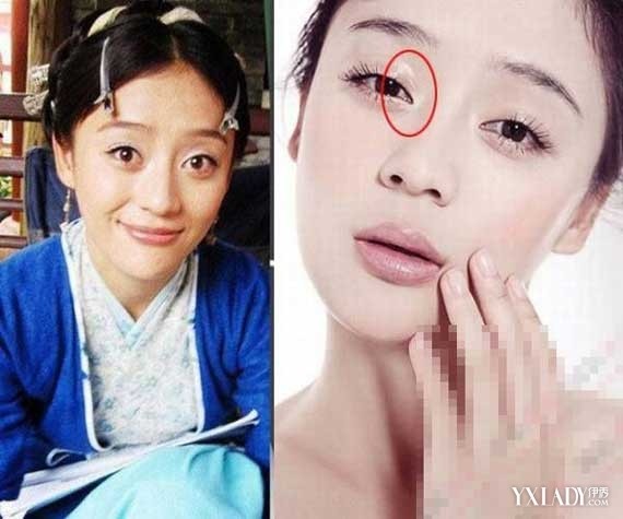 曝袁姗姗整容前照片,揭袁姗姗为什么会被封杀于正喜欢袁姗姗原因