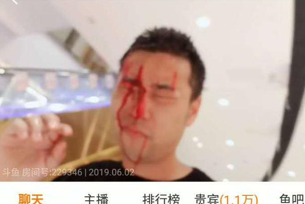 斗鱼钱小佳爆头事件怎么回事?斗鱼钱小佳直播被爆头为什么被打?