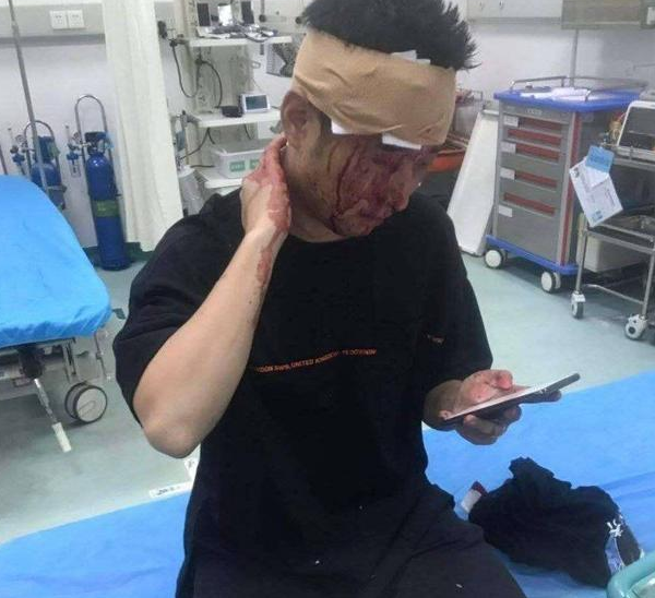 斗鱼钱小佳爆头事件怎么回事?斗鱼钱小佳直播被爆头为什么被打?
